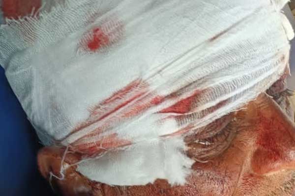 ಮುಂಡಗೋಡ । ಗದ್ದೆಗೆ ತೆರಳುತ್ತಿದ್ದ ವೇಳೆ ಕರಡಿ ದಾಳಿ: ರೈತನ ತಲೆ, ಕೈ, ಕಾಲುಗಳಿಗೆ ಗಾಯ