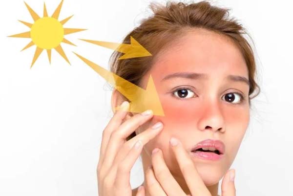 SKIN CARE | ಸೂರ್ಯನ ಹಾರ್ಷ್‌ ಕಿರಣಗಳಿಂದ ಮುಖವೆಲ್ಲ ಟ್ಯಾನ್‌ ಆಗಿದ್ಯಾ? ಈ ಮನೆಮದ್ದು ಟ್ರೈ ಮಾಡಿ